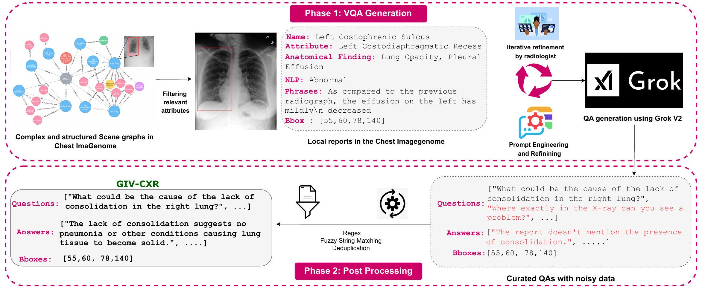 GIV-CXR curation pipeline