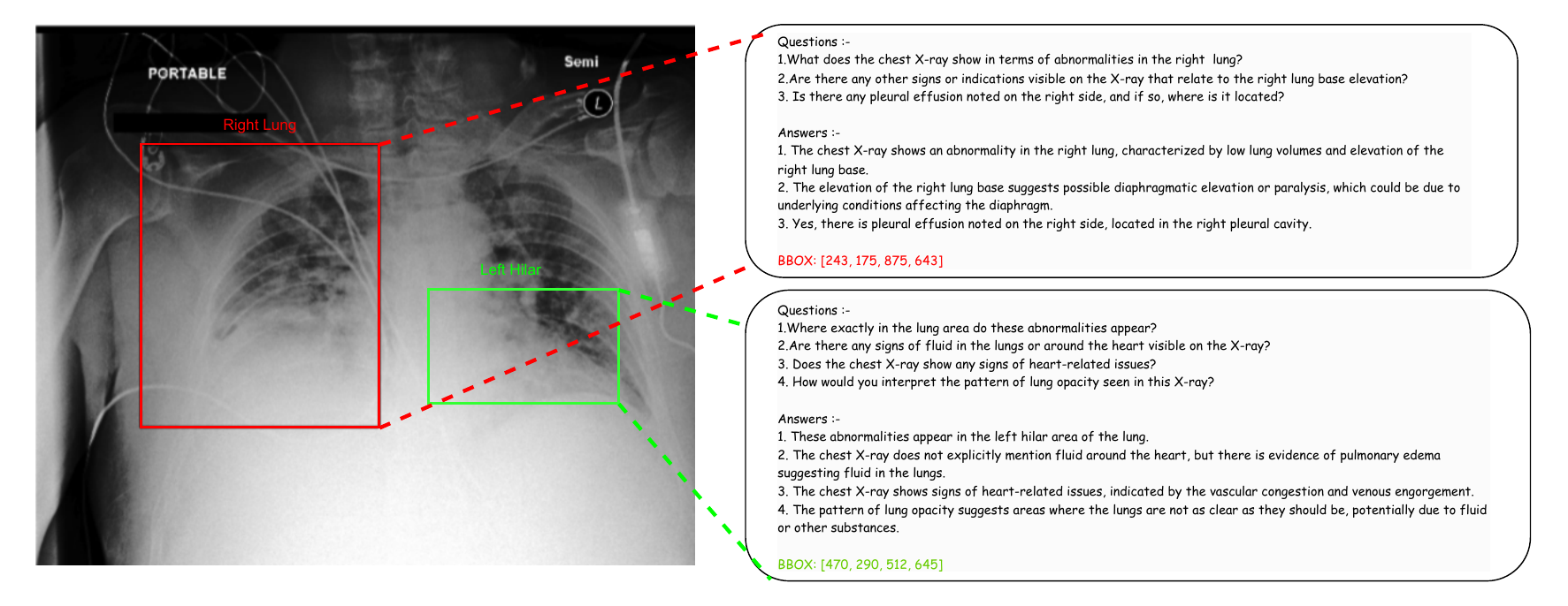 GIV-CXR overview figure